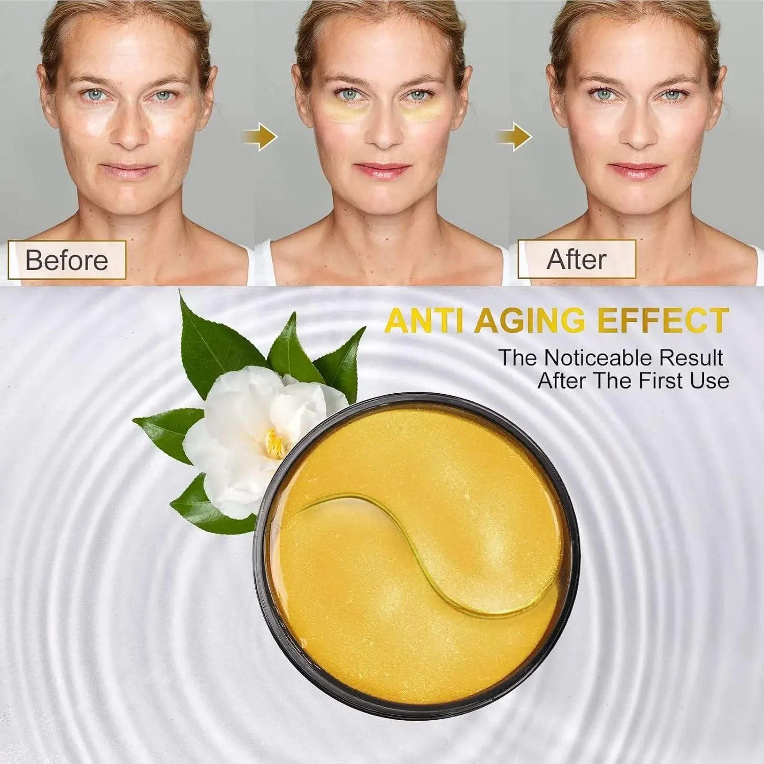 The Ultimate Guide to Laser Treatment For Under Eye Circles in the UK