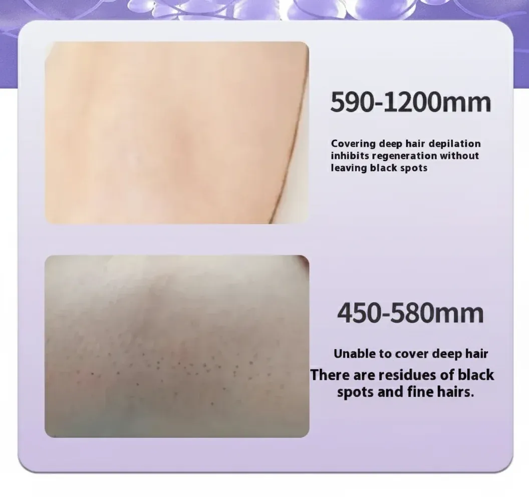 Laser Hair Removal Machine Price Explained: A UK Buyer's Guide
